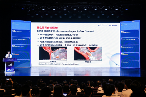 2024年第二届X-Fusion全球创新者聚变大会圆满落幕
