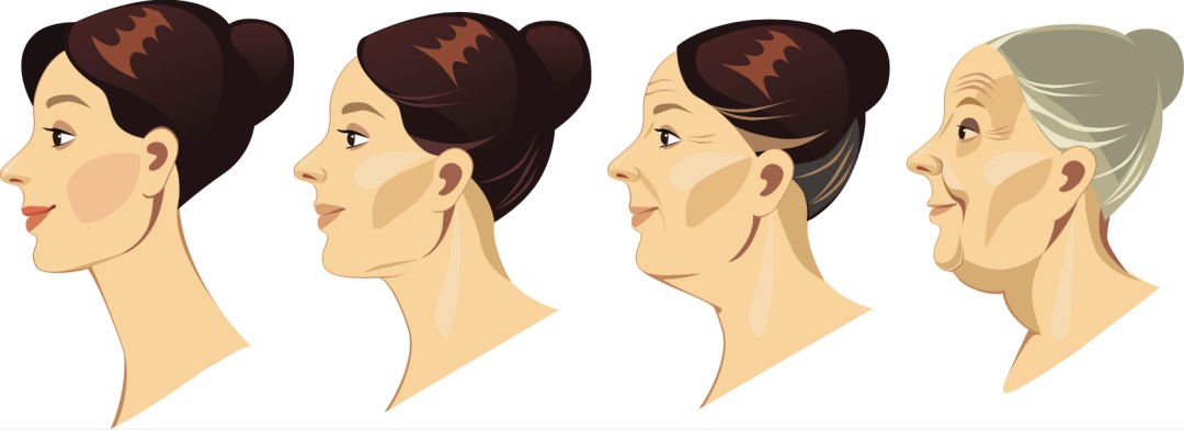 衰老分等级？2级显老、4级年龄感翻倍！杏林除皱